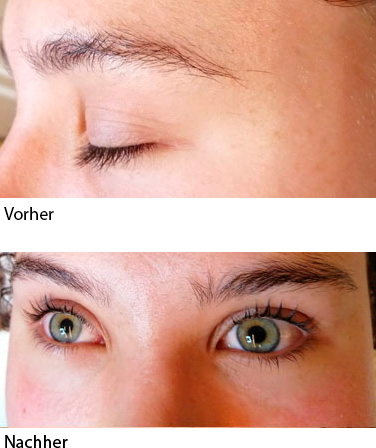 Wimpern- und Browlifting